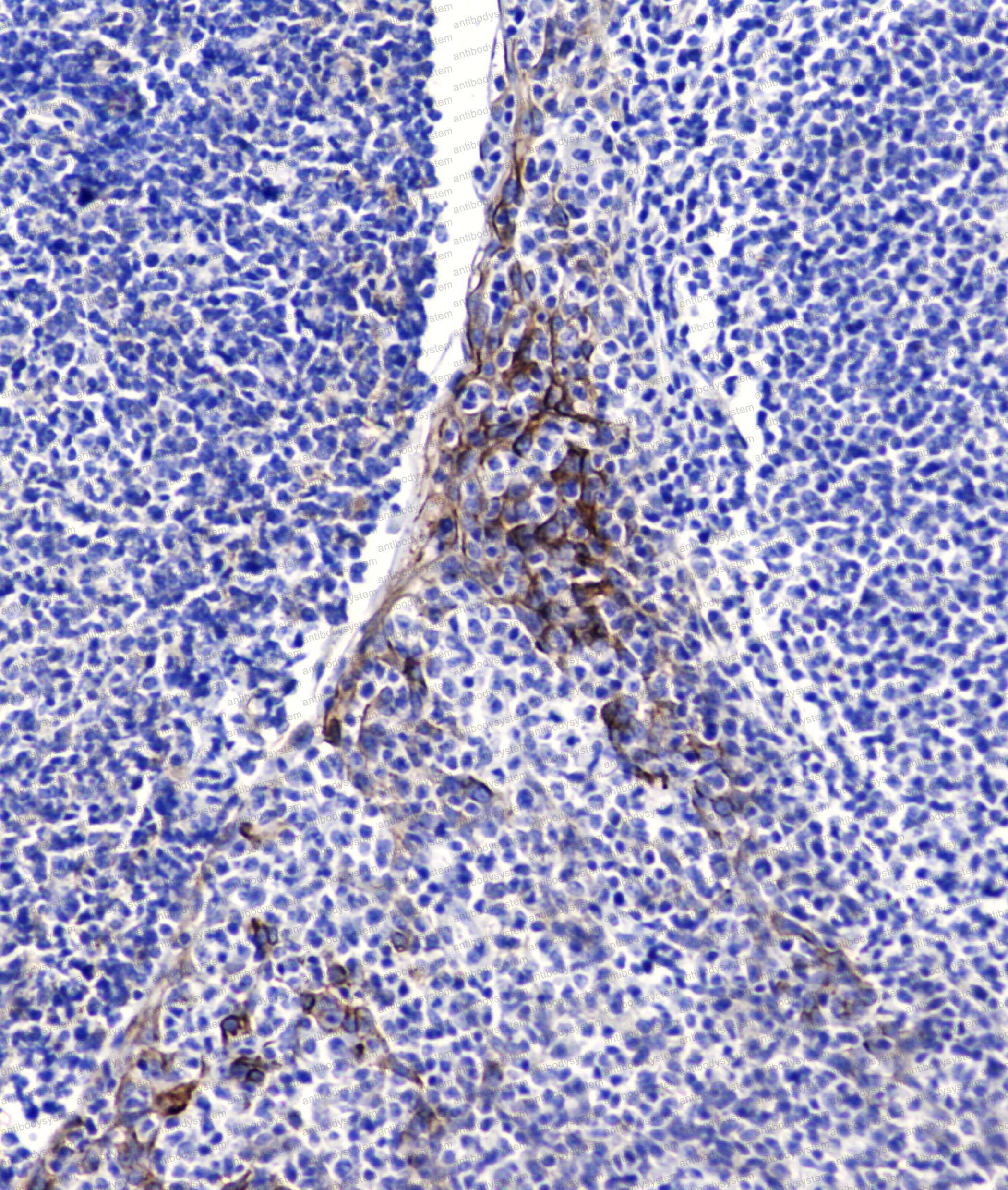 Anti-CD54/ICAM1 Antibody (R2Z21)
