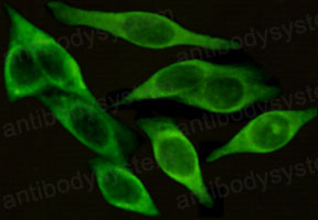 Anti-CD54/ICAM1 Antibody (R2Z22)