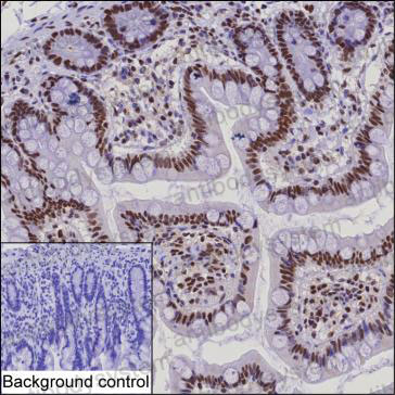 Anti-SSB Antibody (R2Z28)