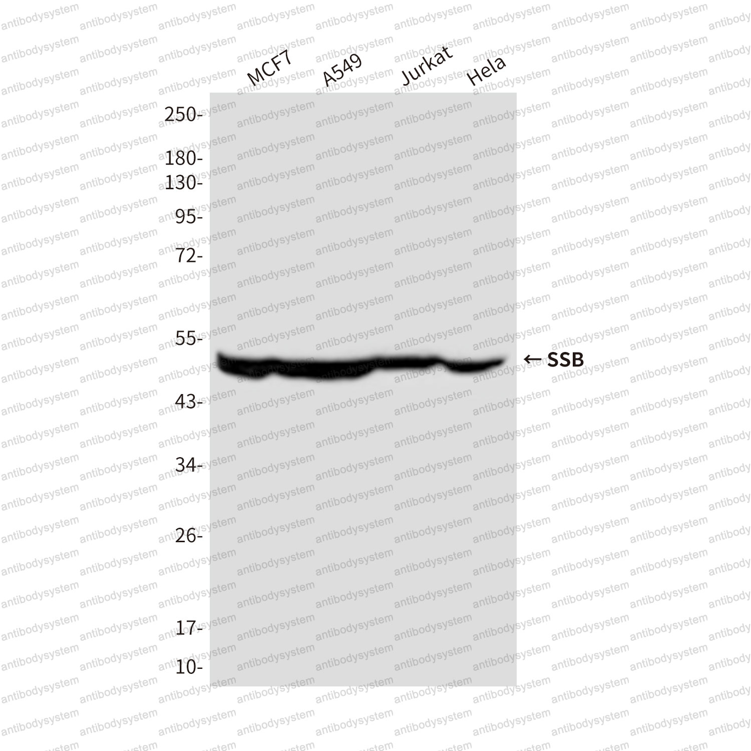 Anti-SSB Antibody (R2Z29)