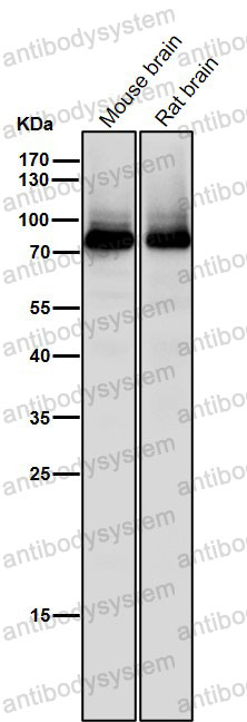 Anti-PRKCB Antibody (R1B49)