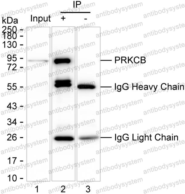 Anti-PRKCB Antibody (R2Z37)