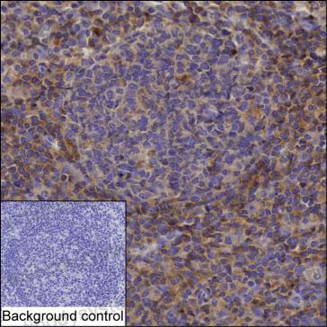 Anti-PRKCB Antibody (R2Z38)
