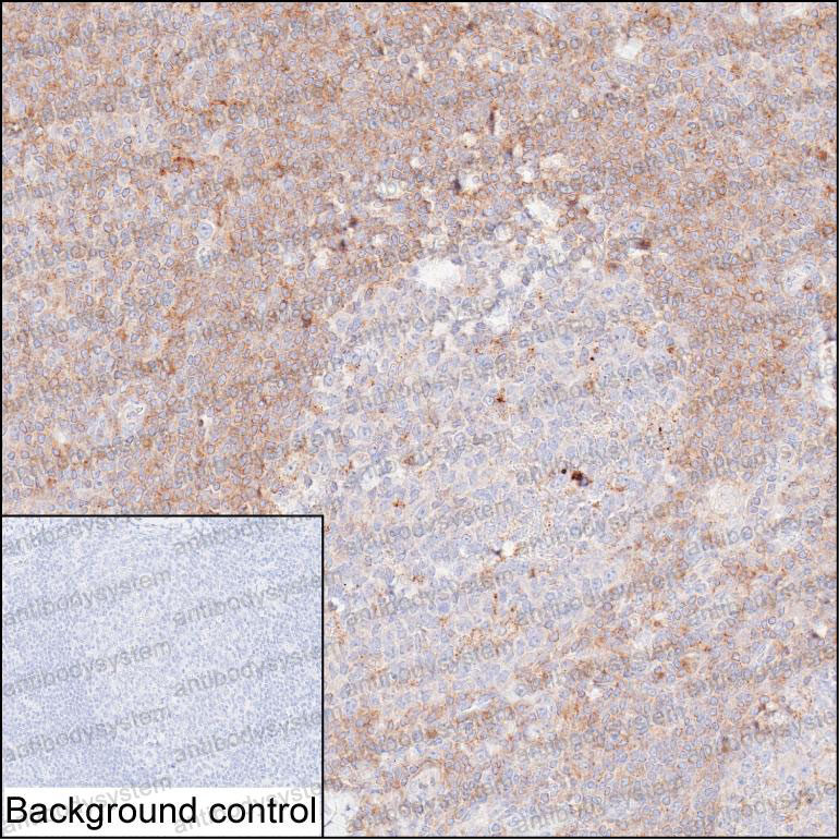 Anti-PRKCB Antibody (R2Z39)