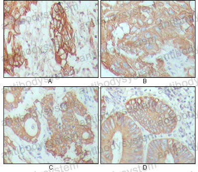 Anti-KRT18 Antibody (R2Z40)
