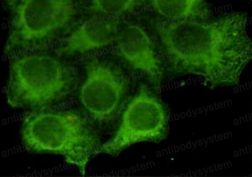 Anti-KRT18 Antibody (R2Z43)