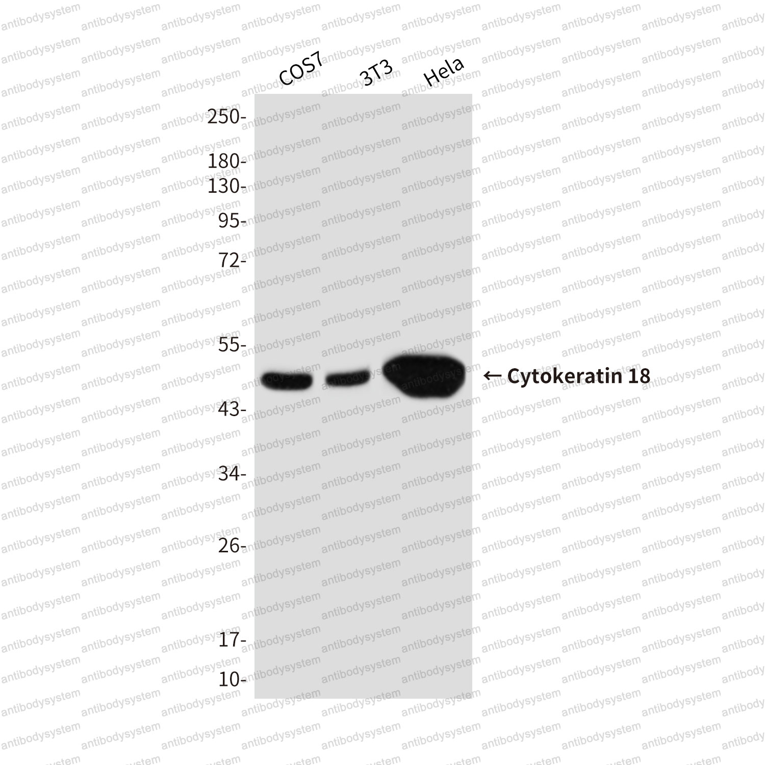 Anti-KRT18 Antibody (R2Z44)