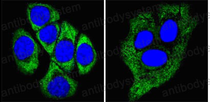 Anti-KRT8/CK-8 Antibody (R2Z45)