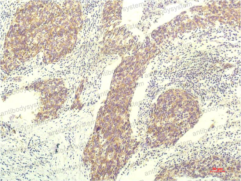 Anti-KRT8/CK-8 Antibody (R2Z46)