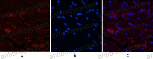 Anti-CD1a Antibody (R2Z51)