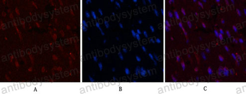 Anti-CD5 Antibody (R2Z56)