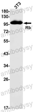 Anti-RB1 Antibody (R1K62)