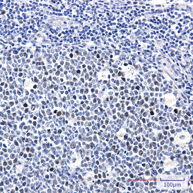 Anti-Phospho-RB1 (Thr252) Antibody (R1K59)
