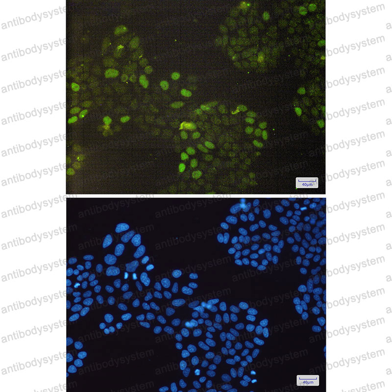 Anti-RB1 Antibody (R1K63)