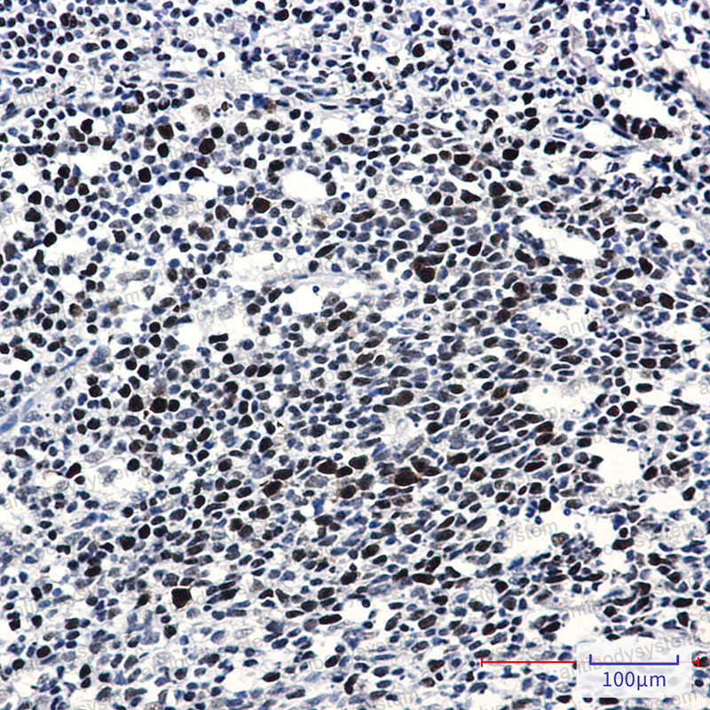 Anti-Phospho-RB1 (Thr356) Antibody (R1K60)