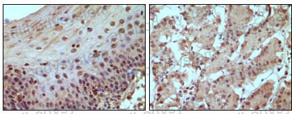 Anti-RB1 Antibody (R2Z63)
