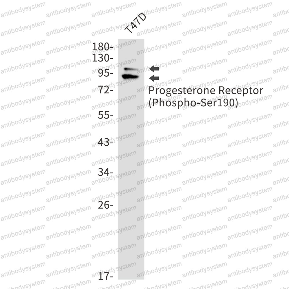 Anti-Phospho-PGR (Ser190) Antibody (R1K64)
