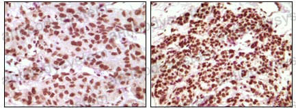 Anti-PGR Antibody (R2Z66)