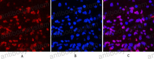 Anti-PGR Antibody (R2Z69)
