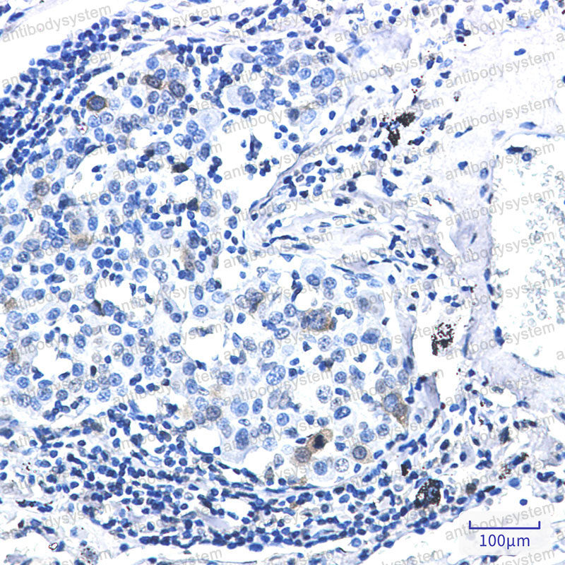 Anti-Phospho-CDK1/2 (Thr14) Antibody (R1K66)