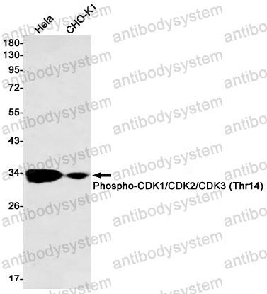 Anti-Phospho-CDK1/2/3 (Thr14) Antibody (R1K65)