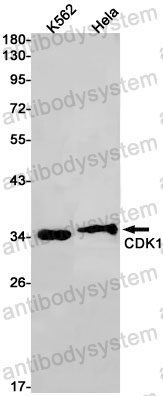 Anti-CDK1 Antibody (R1K67)