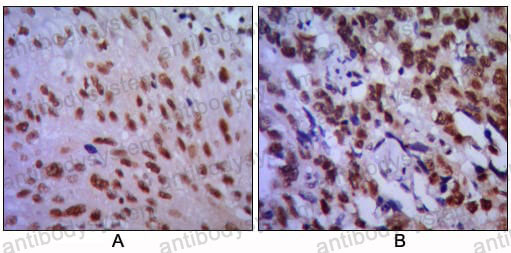 Anti-CDK1 Antibody (R2Z70)