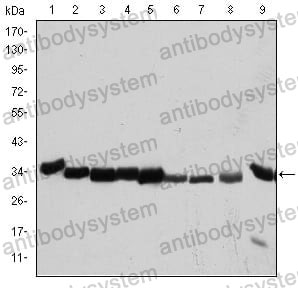 Anti-CDK1 Antibody (R2Z72)