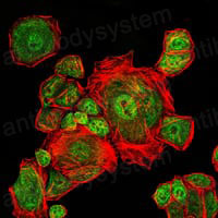 Anti-CDK1 Antibody (R2Z73)