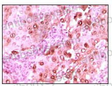 Anti-S100A6 Antibody (R2Z76)