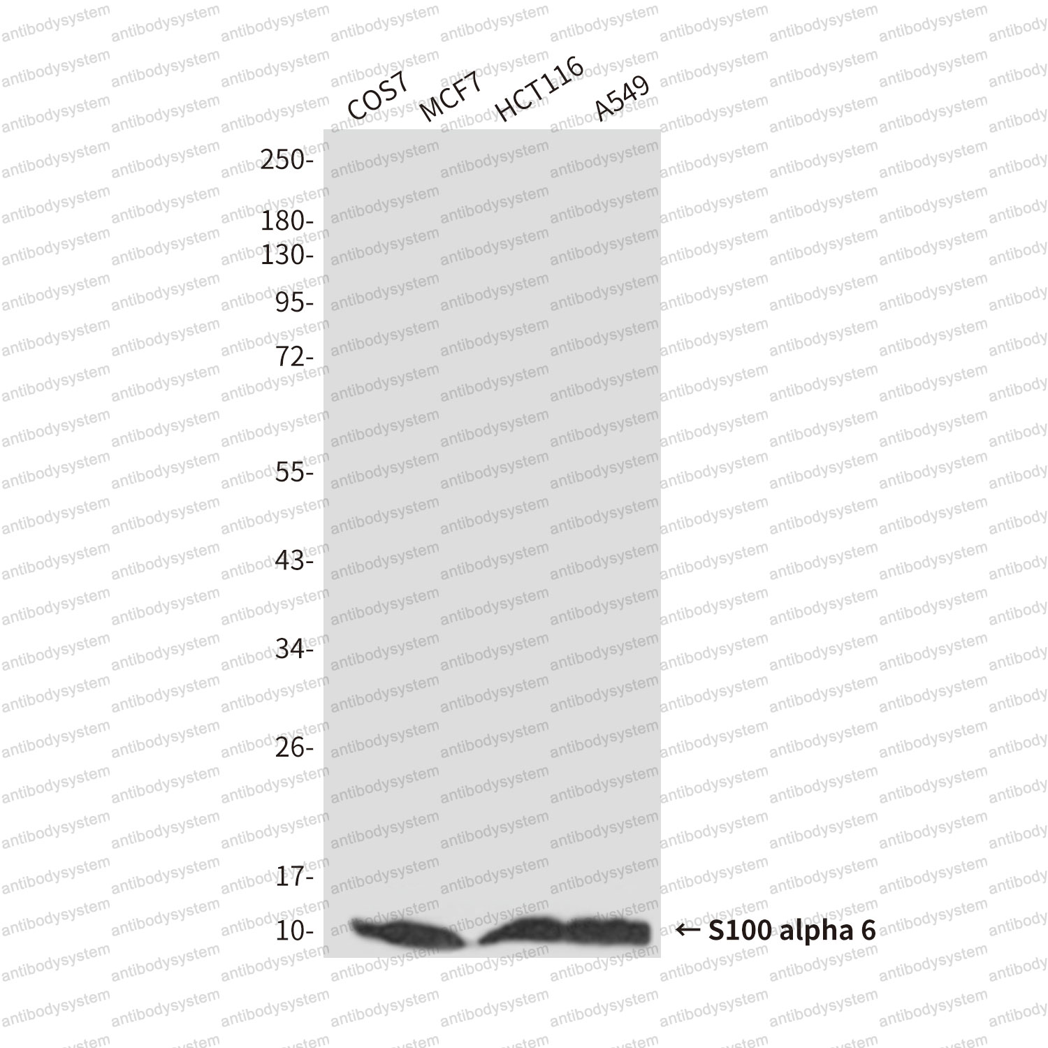 Anti-S100A6 Antibody (R2Z77)