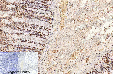 Anti-CD2 Antibody (R2Z82)