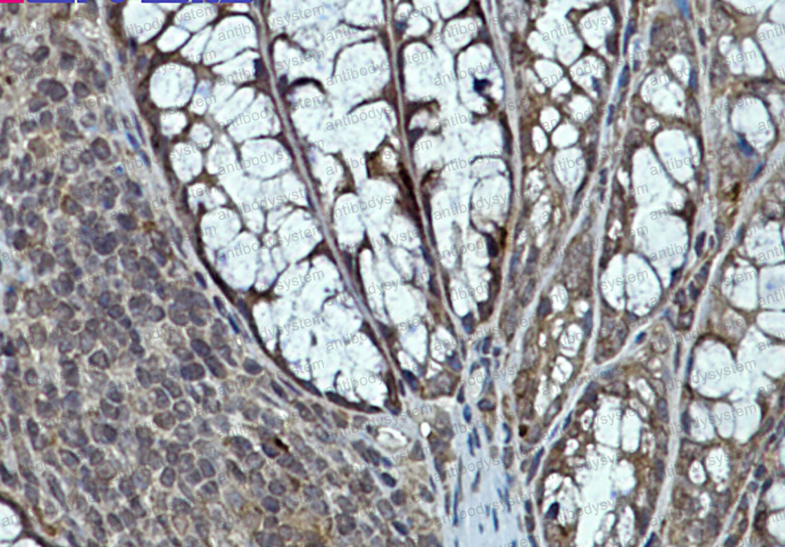 Anti-EIF4E Antibody (R1K74)