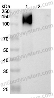 Anti-Human CD66e/CEA/CEACAM5 Antibody (SAA2059)