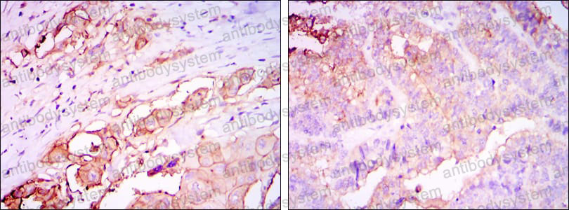 Anti-CD66e/CEA/CEACAM5 Antibody (R2Z86)