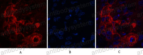 Anti-CD66e/CEA/CEACAM5 Antibody (R2Z89)