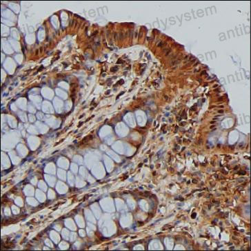 Anti-ENO1/Alpha-enolase Antibody (R2Z91)