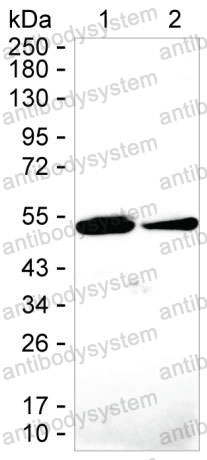 Anti-ENO1/Alpha-enolase Antibody (R2Z92), HRP