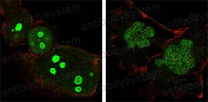 Anti-NPM1 Antibody (R2Z97)
