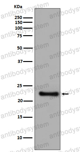 Anti-GPX1 Antibody (R1K91)