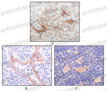 Anti-FES Antibody (R3A16)