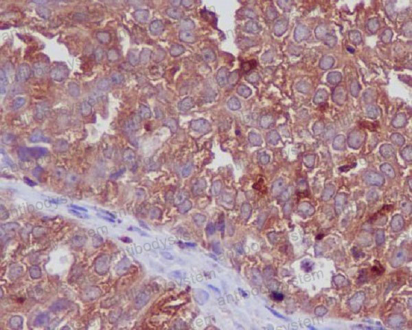 Anti-CTSD/Cathepsin D Antibody (R1B33)