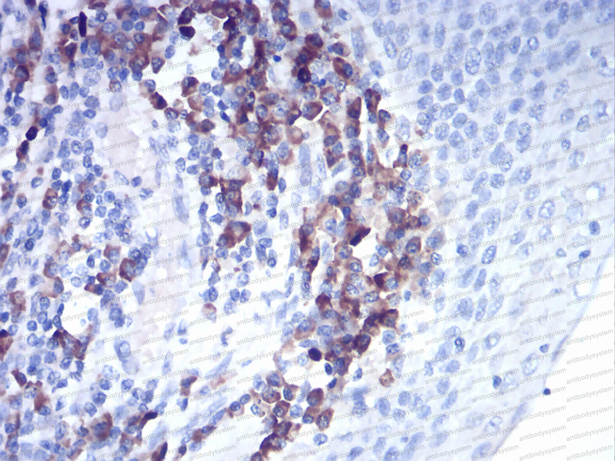 Anti-CTSD/Cathepsin D Antibody (R3A20)