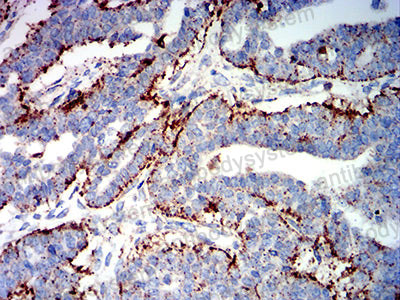 Anti-PSAP Antibody (R3A32)