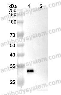 Anti-Human CTSB Antibody (2A2)