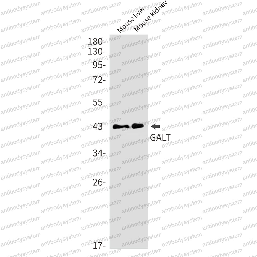 Anti-GALT Antibody (R1L23)