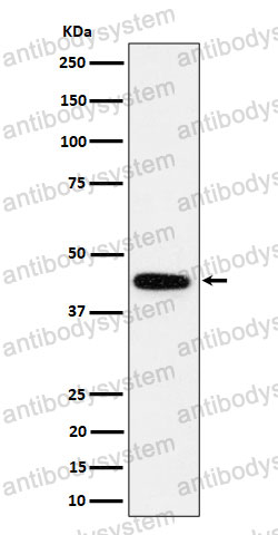 Anti-GALT Antibody (R1L22)