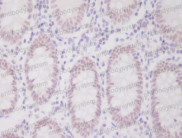 Anti-HNRNPC1/C2 Antibody (R1L24)