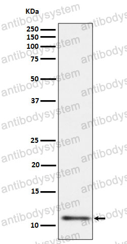 Anti-UQCRH Antibody (R1L25)