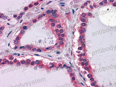 Anti-LAMB1 Antibody (R3A38)